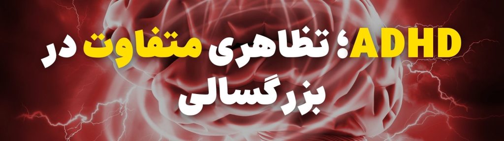 بیش فعالی